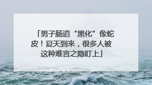 男子肠道“黑化”像蛇皮！夏天到来，很多人被这种难言之隐盯上